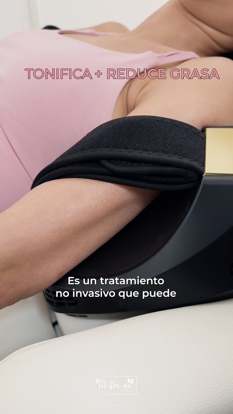 HIFEM en brazos