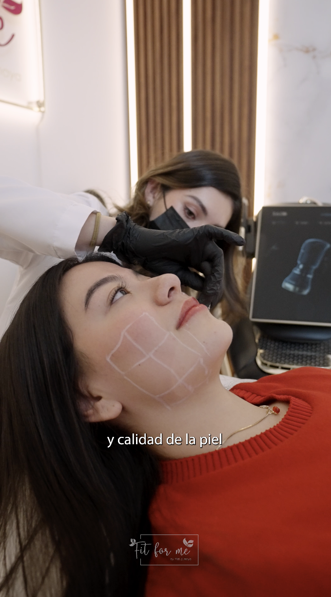 HIFU lifting facial sin cirugía en San Luis Potosí